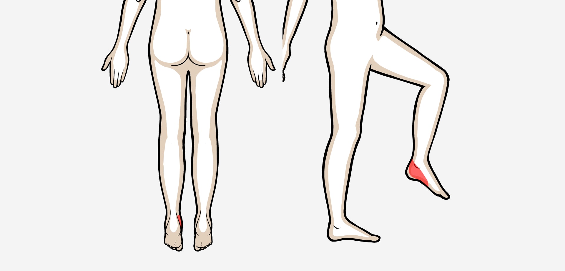 Dolor difuso medial